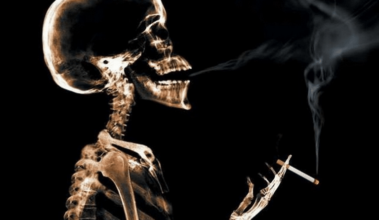 Smoking-and-Bone-Health