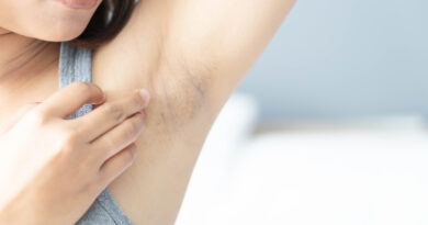 To-remove-armpit-darkening-at-home