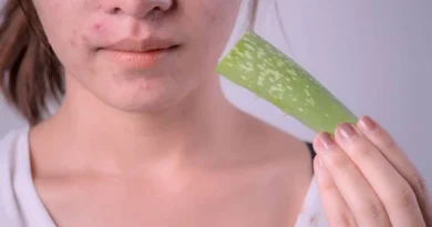 Aloe Vera: Nature's Soothing Elixir for Acne-Prone Skin