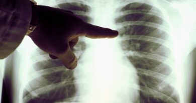 What are genetic factors of lung cancer and how risky are they?