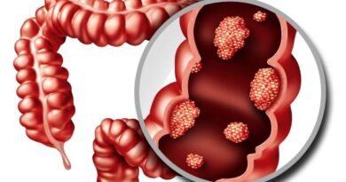 Why-are-young-people-more-prone-to-colon-cancer-in-india