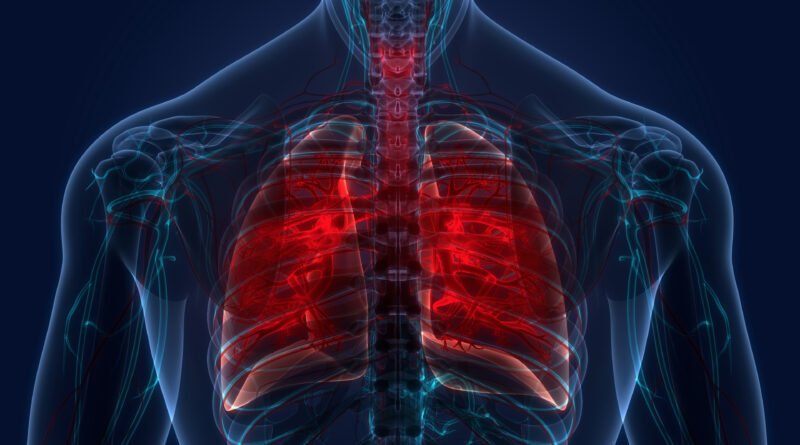 All-About-Tuberculosis