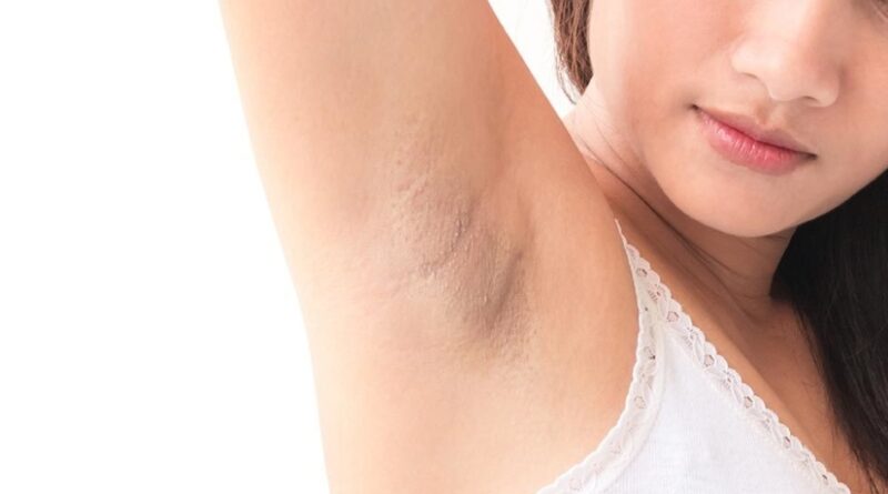 How-to-Lighten-Your-Underarms