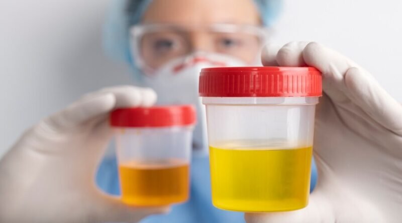 Health-can-be-determined-by-the-color-of-urine