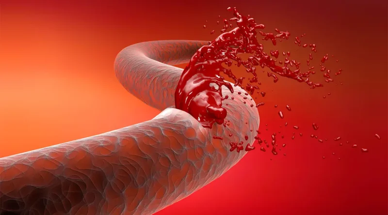 What-is-Hemophilia