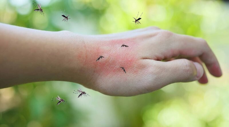 mosquito-bites