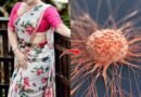 Understanding-Saree-Cancer