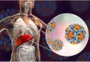 Hepatitis-A