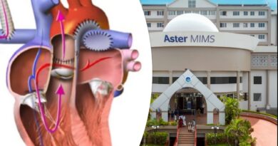 norwood-surgery-aster-mims-calicut