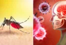neurological-disorders-due-to-dengue
