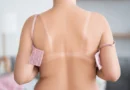 tight-bra-health-issues
