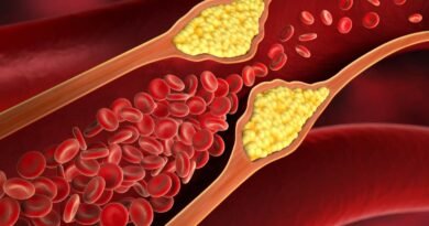 common-myths-related-to-cholesterol