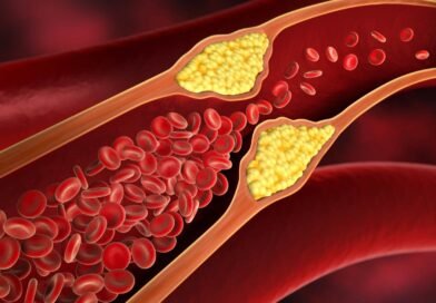 common-myths-related-to-cholesterol