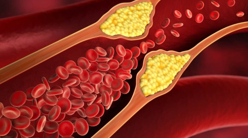 common-myths-related-to-cholesterol