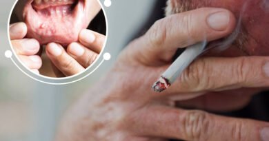 smoking-cigarettes-can-also-cause-lip-cancer