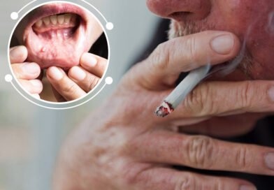smoking-cigarettes-can-also-cause-lip-cancer
