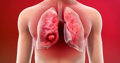 Why-are-non-smokers-also-becoming-victims-of-lung-cancer