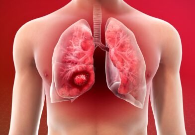 Why-are-non-smokers-also-becoming-victims-of-lung-cancer