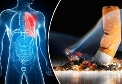 those-who-have-the-habit-of-smoking-must-undergo-medical-tests