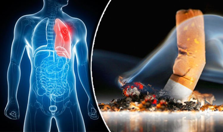 those-who-have-the-habit-of-smoking-must-undergo-medical-tests