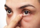 the-initial-stage-of-diabetes-is-known-by-the-eyes