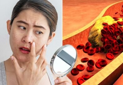 if-you-see-these-changes-in-the-face-it-means-that-bad-cholesterol-in-the-body-has-increased