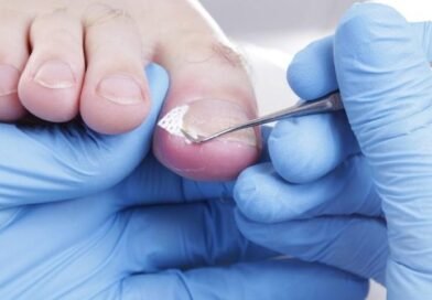 toenail-problems