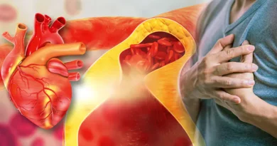 doctor-advises-natural-ways-to-reduce-bad-cholesterol-in-30-days