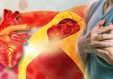 doctor-advises-natural-ways-to-reduce-bad-cholesterol-in-30-days