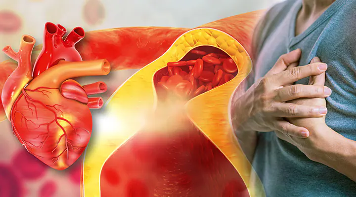 doctor-advises-natural-ways-to-reduce-bad-cholesterol-in-30-days