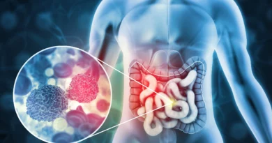 the-silent-signs-of-colorectal-cancer