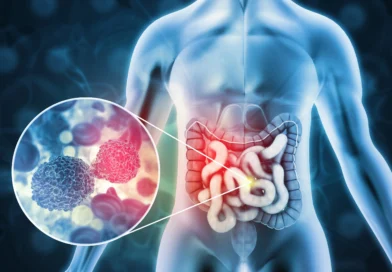 the-silent-signs-of-colorectal-cancer