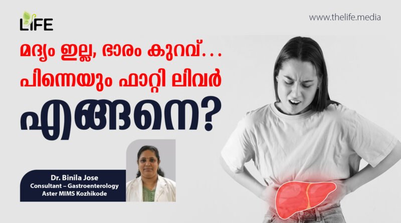lean-fatty-liver-dr-binila-jose-mims-calicut