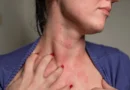hypothyroidism-warning