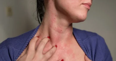 hypothyroidism-warning