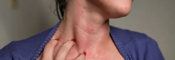 hypothyroidism-warning