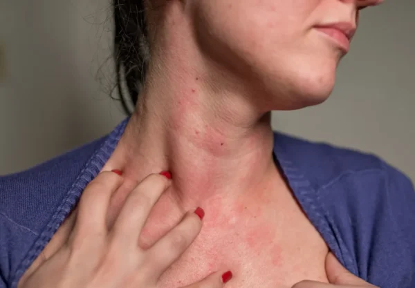 hypothyroidism-warning