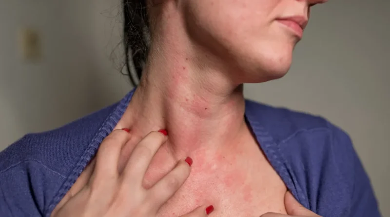 hypothyroidism-warning