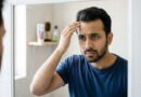 87% of Men Seeking Hair Loss Treatment Are Under 35